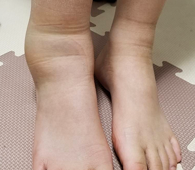 足首の写真